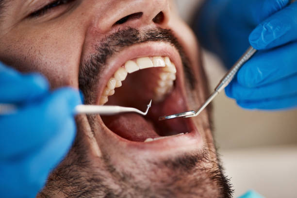Best Broken or Chipped Tooth Repair in Lindenhurst, NY